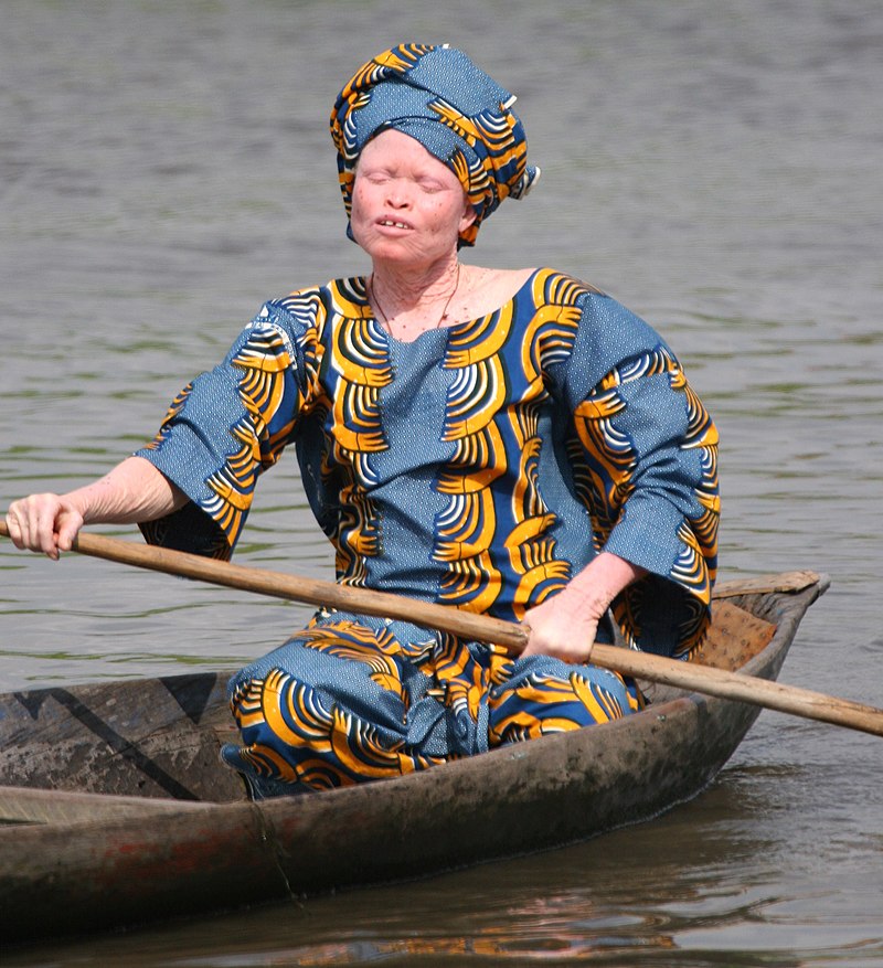 800px-Albino_woman_in_canoe%2C_Benin_%28cropped%29.jpg