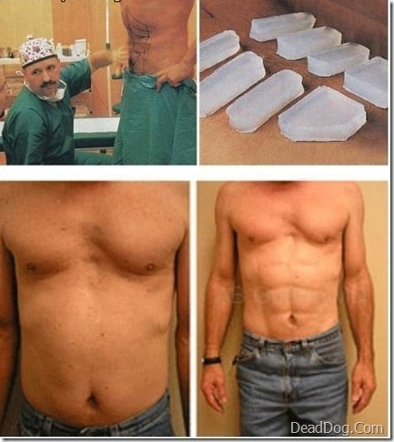 ab-implants.jpg