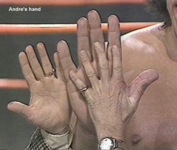 andre-hands.jpg