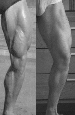 arnold-jos-leg-bw.jpg