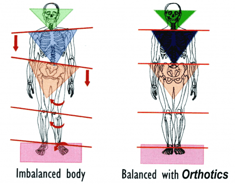 balance_posture_orthotics.png