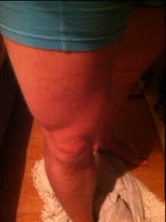 BB 5 weken benen.JPG