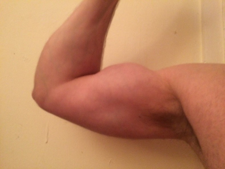 biceps.jpg