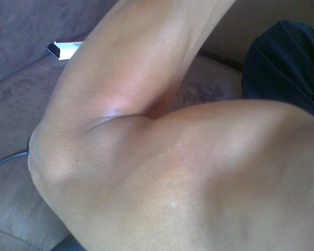 biceps pols recht.jpg