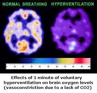 brain-oxygen-effects-hypocapnia-hyperventilation.jpg