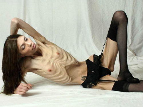 cute-anorexic-girl.jpg