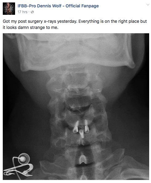 Dennis-Wolf-Post-Operation11-1.jpg