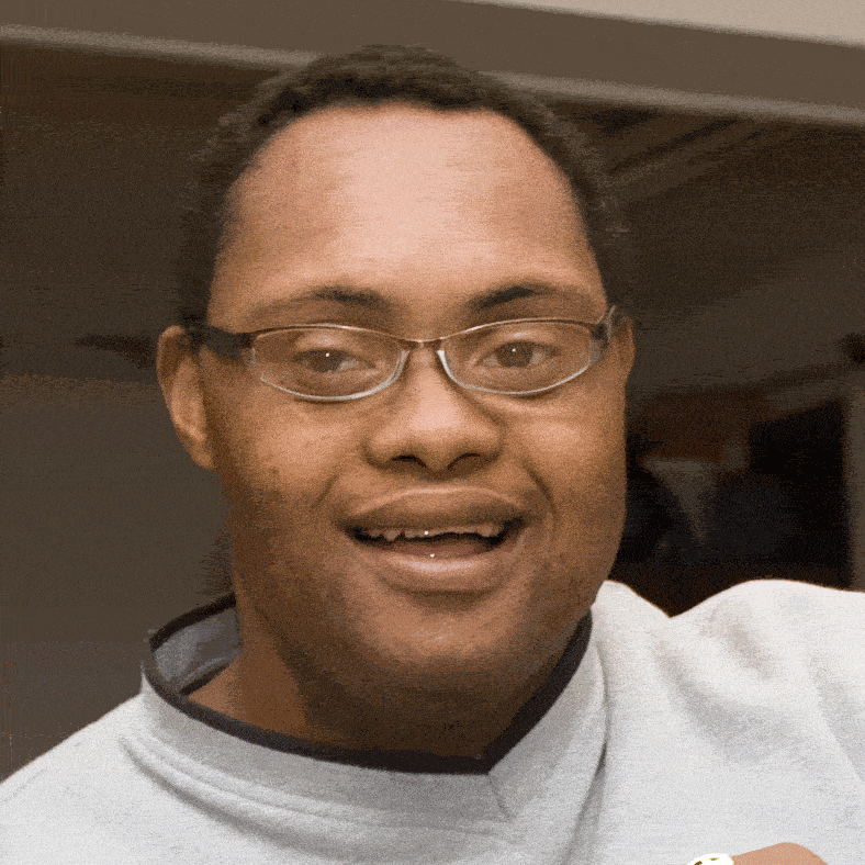 Down-Syndrome-4.gif