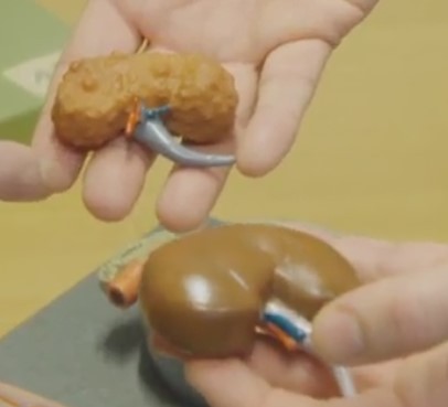 gezonde vs ongezonde nier.jpg