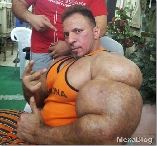 hombre-inflado-synthol-sintol-aceite-ridiculo-20_thumb.jpg