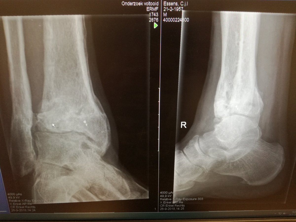 IMG_20180926_160429 (002).jpg