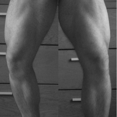 legs-bw.jpg
