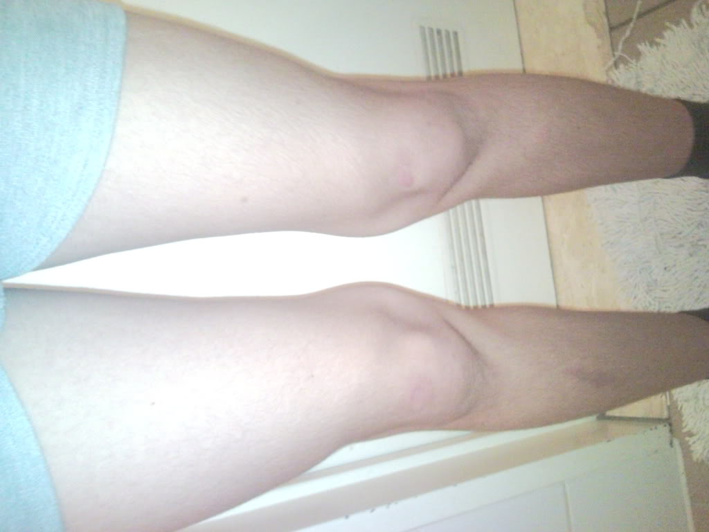 Legs1.jpg