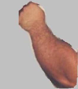 Onderarm Broertje.JPG