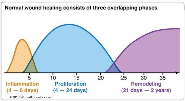 phases-of-wound-healing-2.jpg