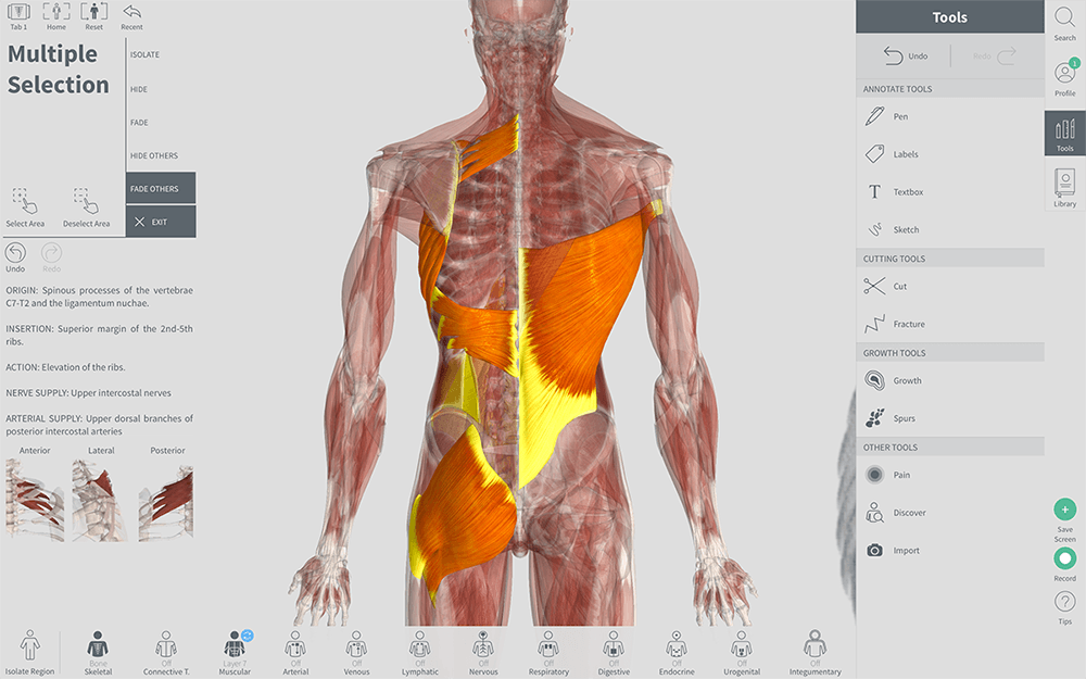 Schermafbeelding 2017-11-08 om 21.29.15.png