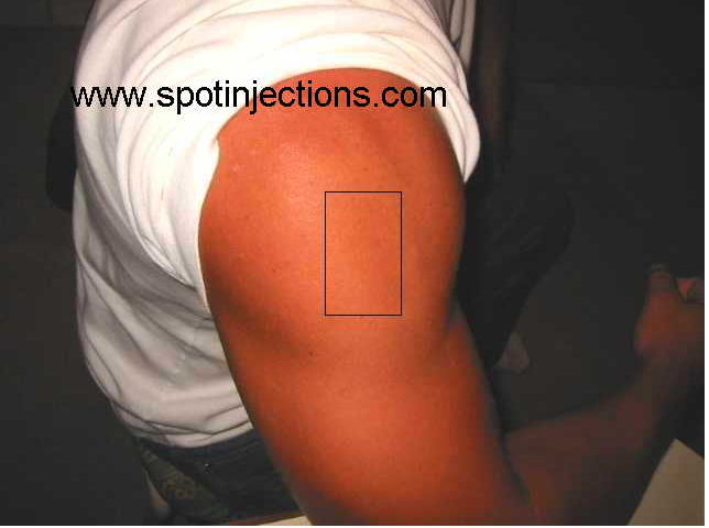 Schermafdruk van 2023-03-09 15-15-33.png