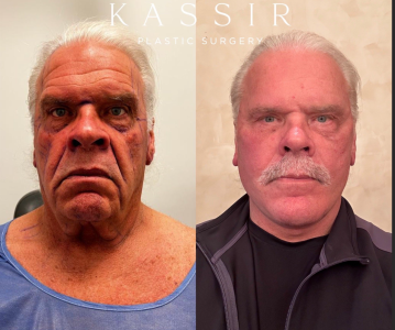 1728056221481.png - 654373