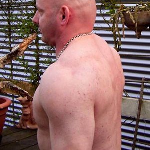 Tricepc/schouder na 5 maanden