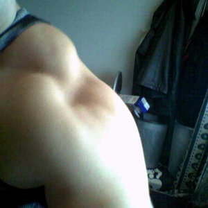 beoordeel me schouder