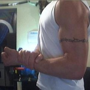 Biceps1