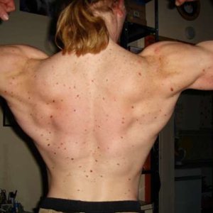 back double biceps
