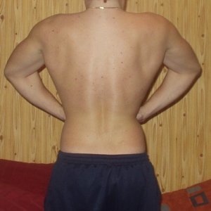 Lat spread
