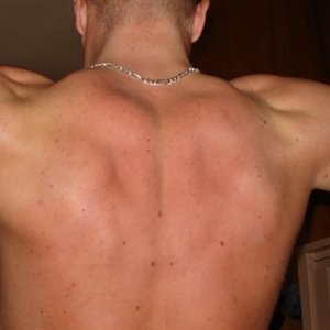 mijn rug zoals je kan zien