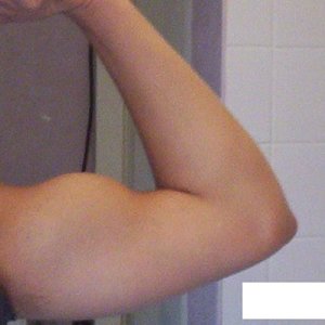 Biceps