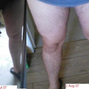 Vergelijking benen na 1 maand