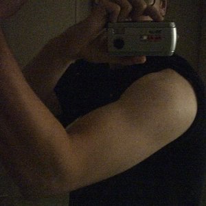 foto arm