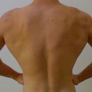 Rug 2 maanden geleden