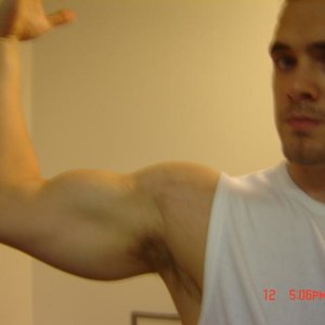 Bicep