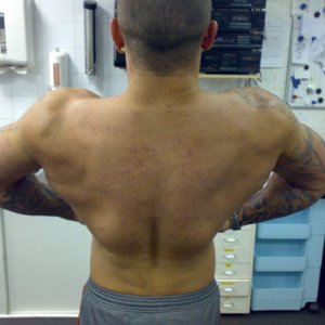 lat spread