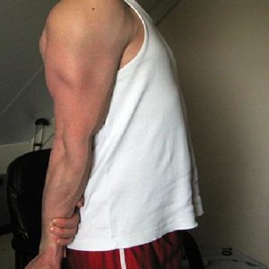 Triceps