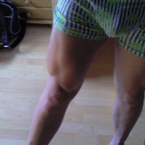 Quads