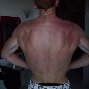 lat spread