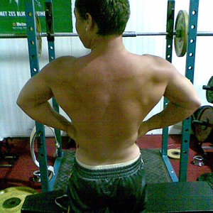 Mijn rug toen ik 15 was.