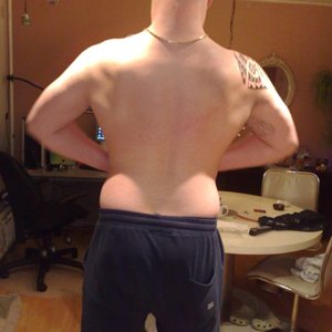Muscle back