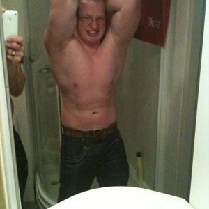 31-05-2010  abdominal thigh