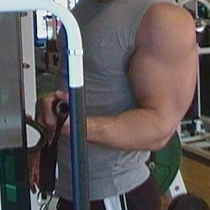 bicep