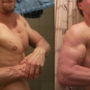 vasculaire pose vs gewone pose.