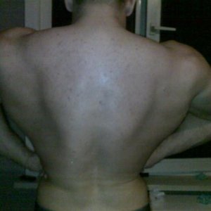 Back