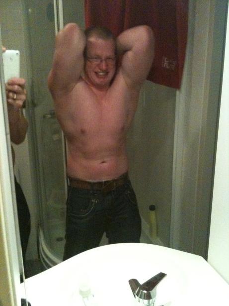 31-05-2010  abdominal thigh