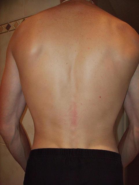 Back no pose na 6 maandjes