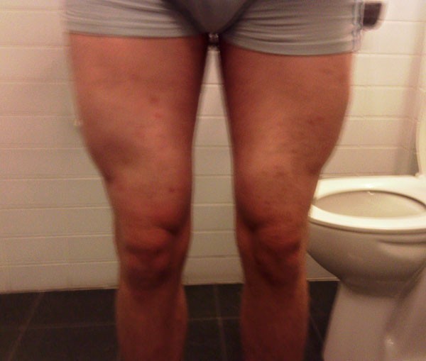 Benen na 3,5 maanden