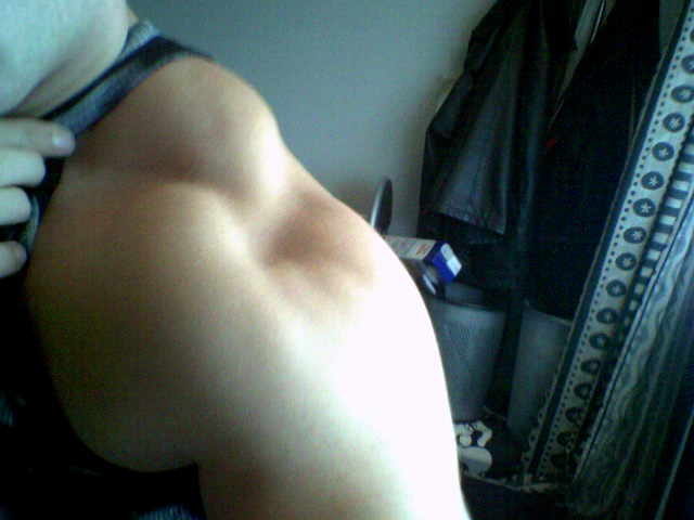 beoordeel me schouder