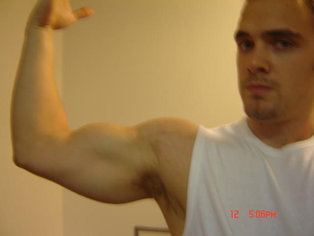Bicep