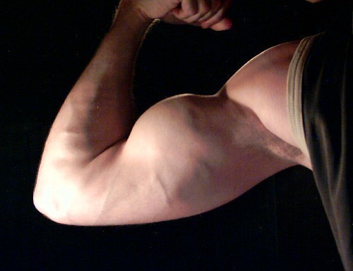 Bicep