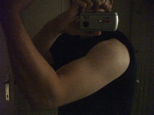 foto arm